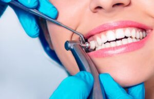 Dental Cleanings